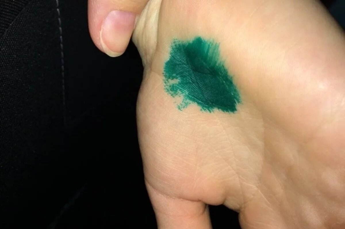    Власти рассказали, как контролируют бешенство на Алтае