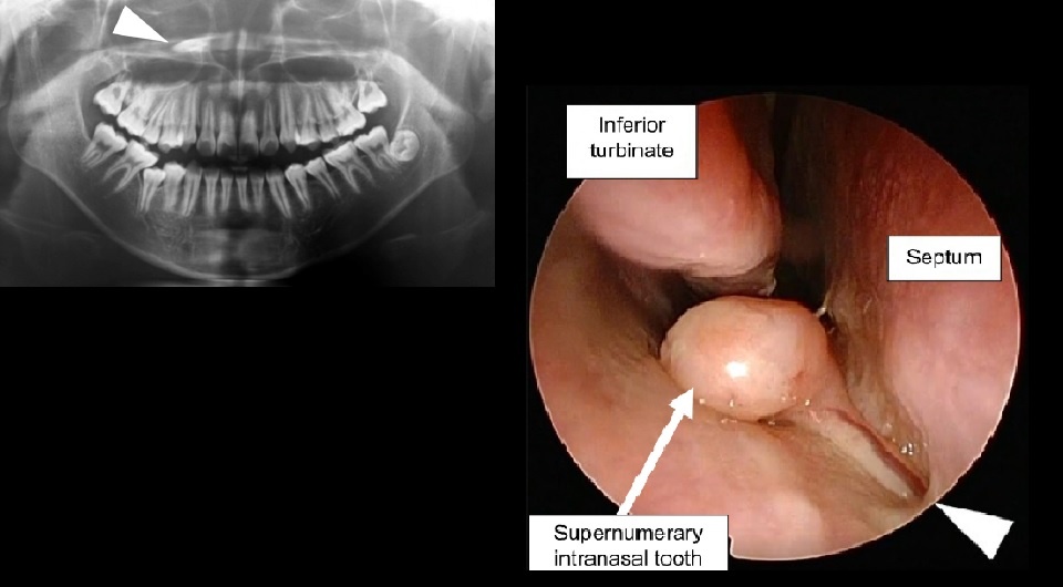   Umezawa et. al / BMJ Case Reports, 2025