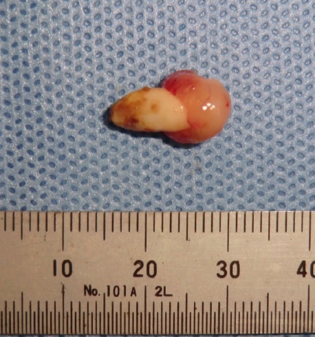   Umezawa et. al / BMJ Case Reports, 2025