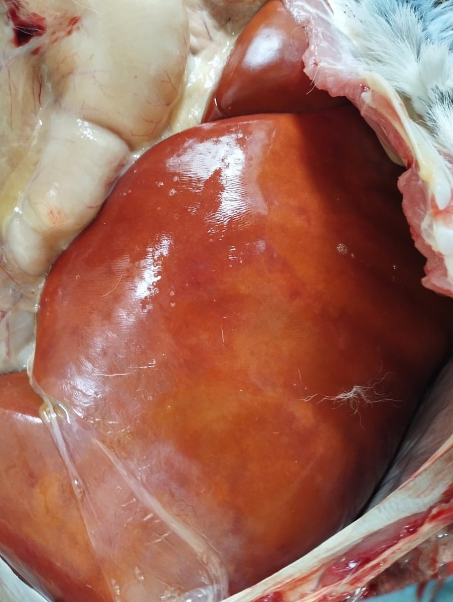 характерный цвет при жировой дистрофии печени