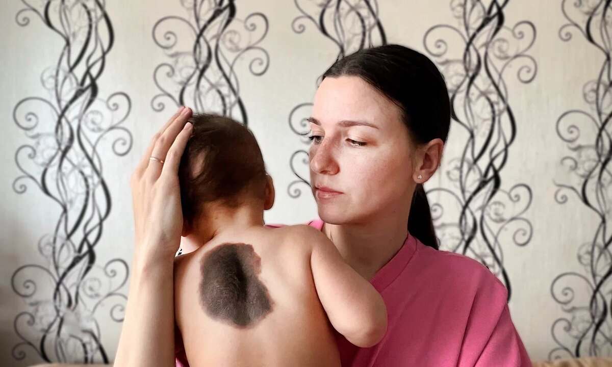 Соня Федосова, подопечная фонда «Алёша»