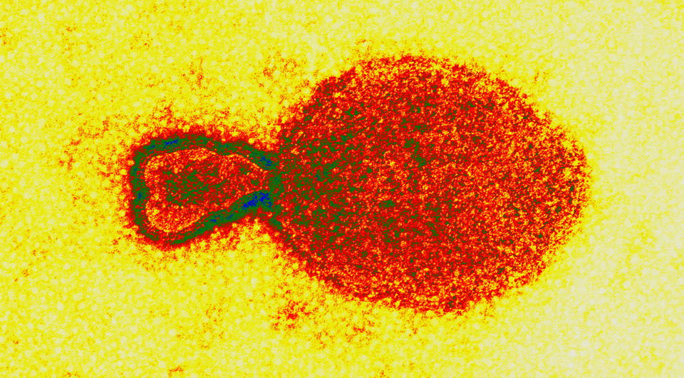   Electron Microscopy Unit AAHL, CSIRO / Wikimedia Commons / CC BY 3.0