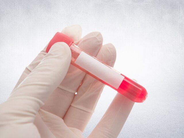    Фото: 123RF/vectorfusionart