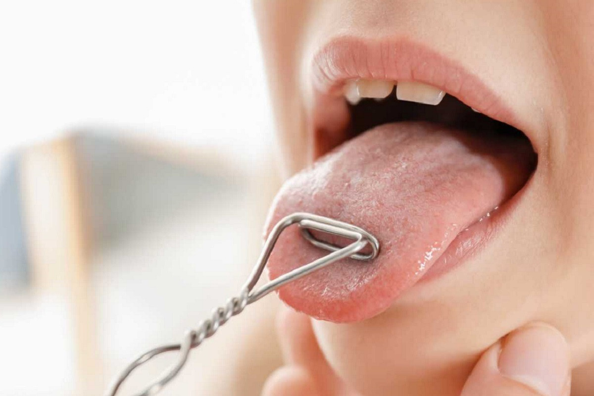 Логопедический массаж в логопедическом центре "Голден спик"