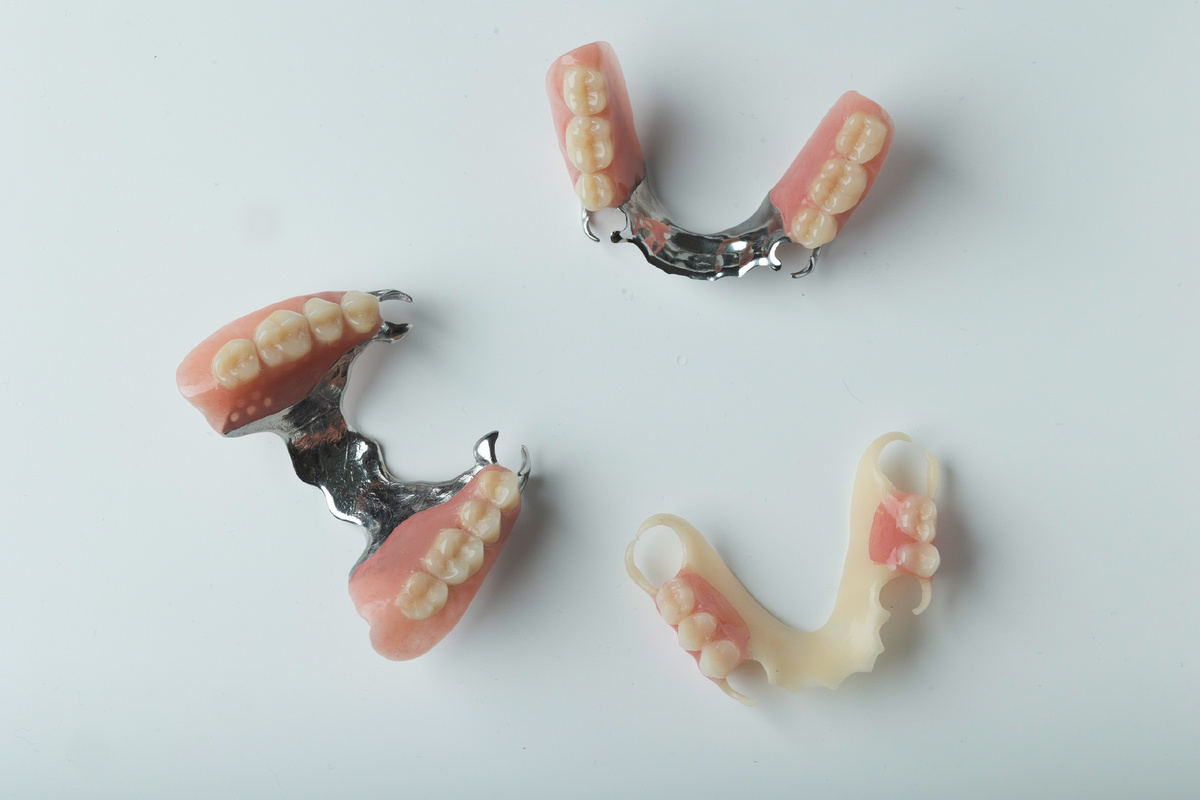 Бюгельный протез