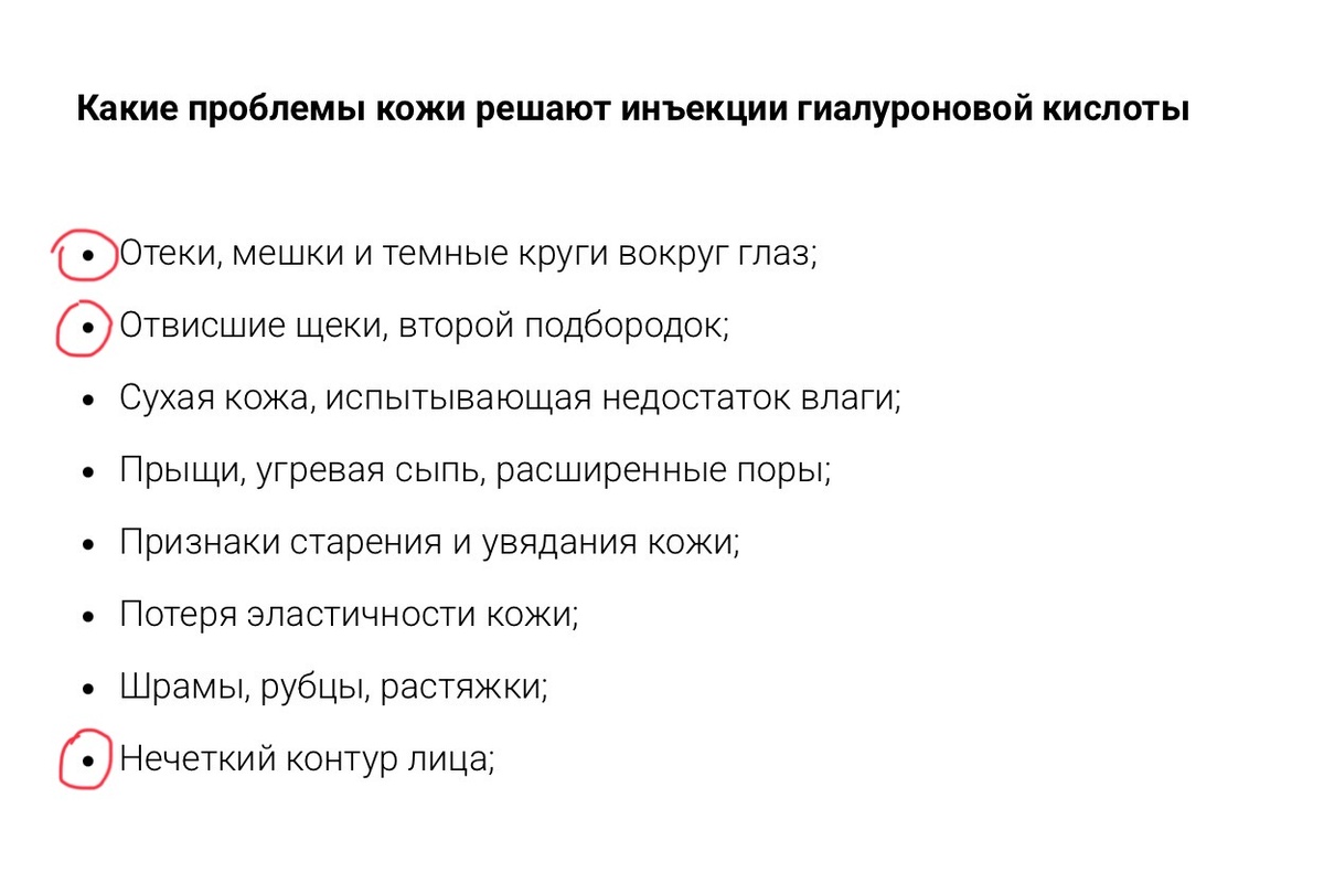 Кружочками обвела проблемы, где сильный отёк УЖЕ есть, и его надо убирать ну точно не у косметолога со шприцом!
