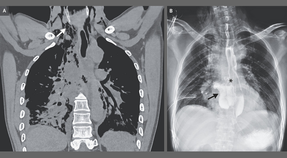   Penghui Wei, Wenyong Zhu / NEJM, 2025