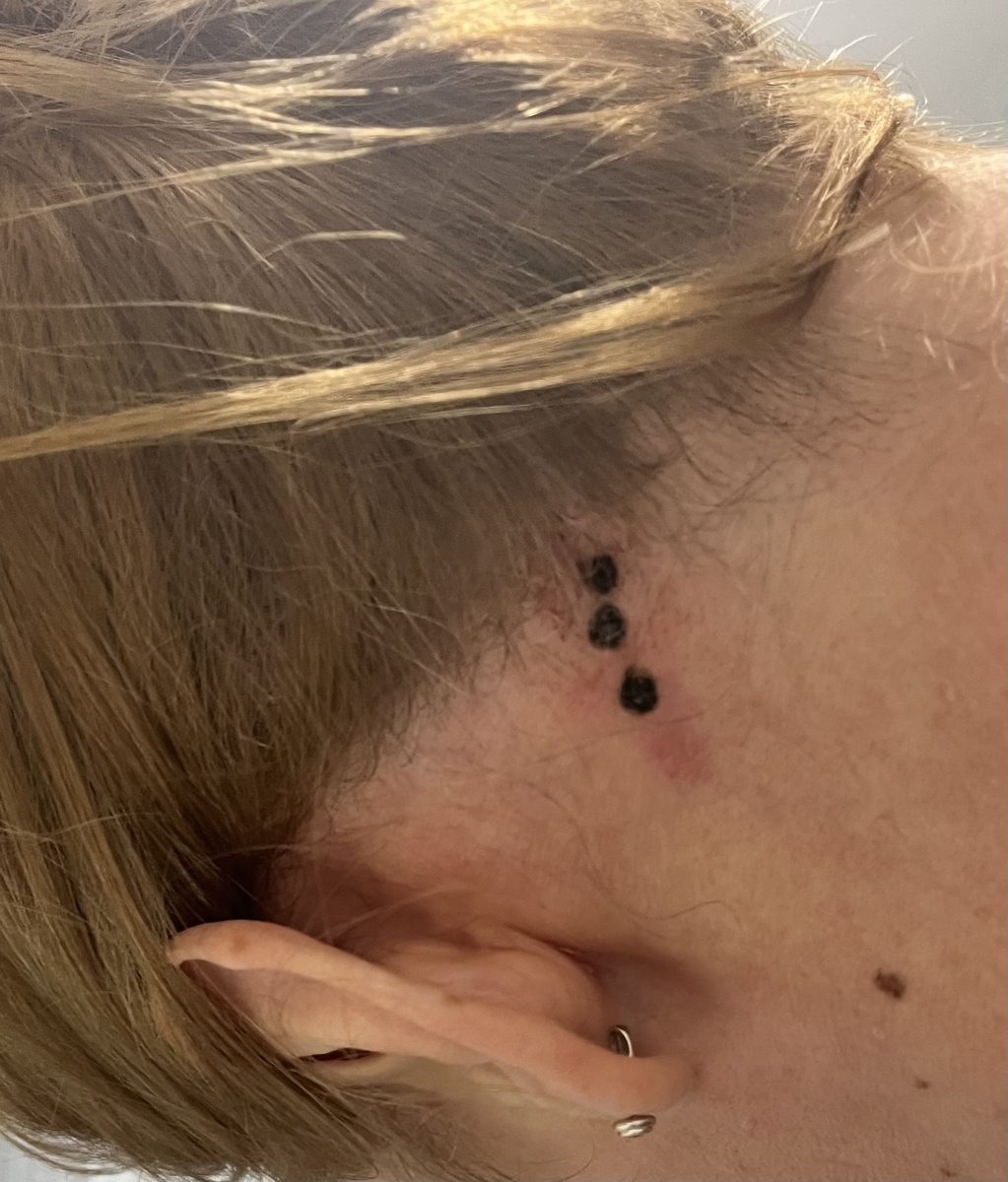 В день удаления. Зима 2025