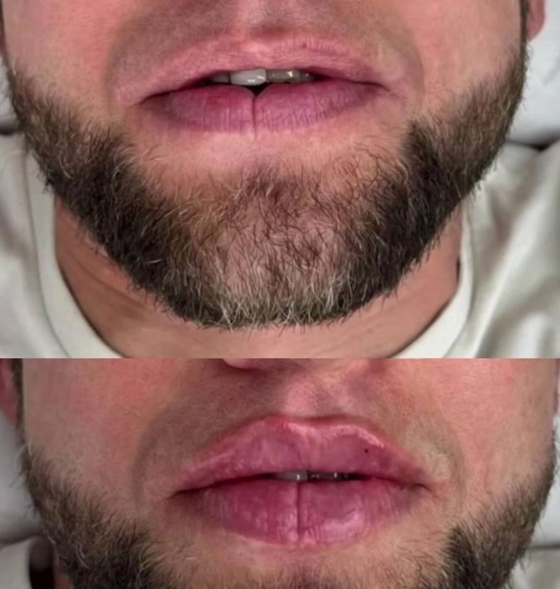 Пухлые губы...