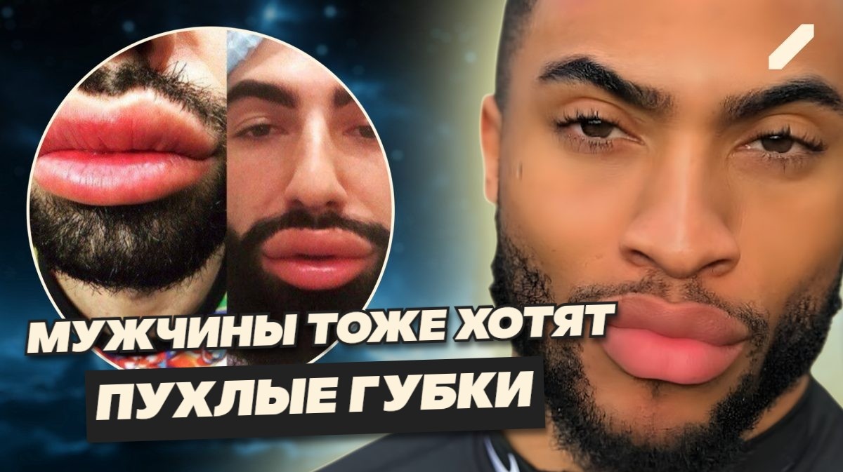 Кавказский феномен: мужчины тайком увеличивают губы, платят в 10 раз больше и боятся быть раскрытыми