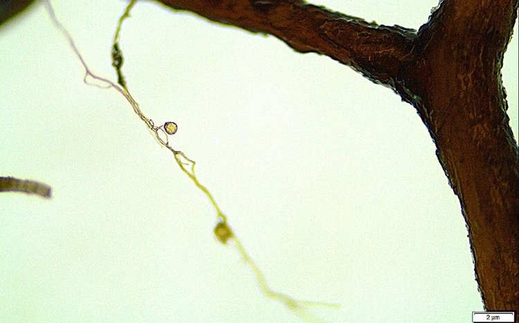    Защитниками биоразнообразия деревьев в лесу неожиданно стали патогенные почвенные грибы