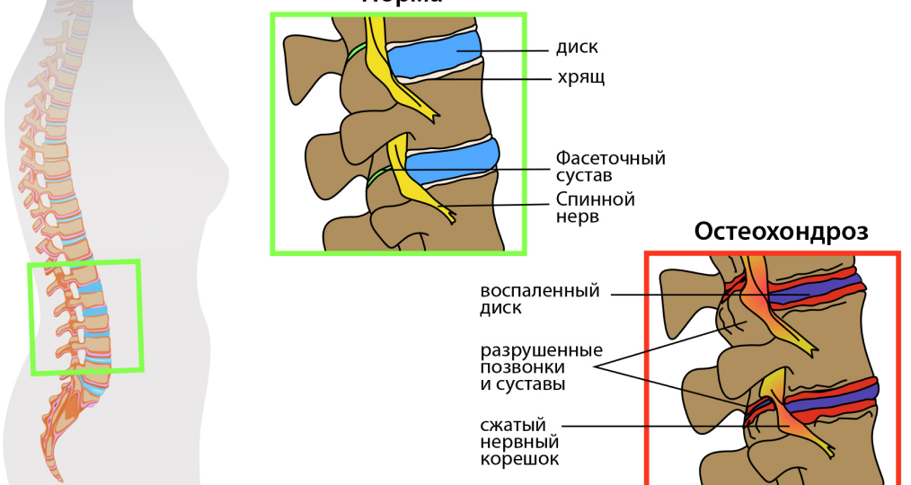 Коллагеновые секреты: как сохранить позвоночник здоровым в любом возрасте?