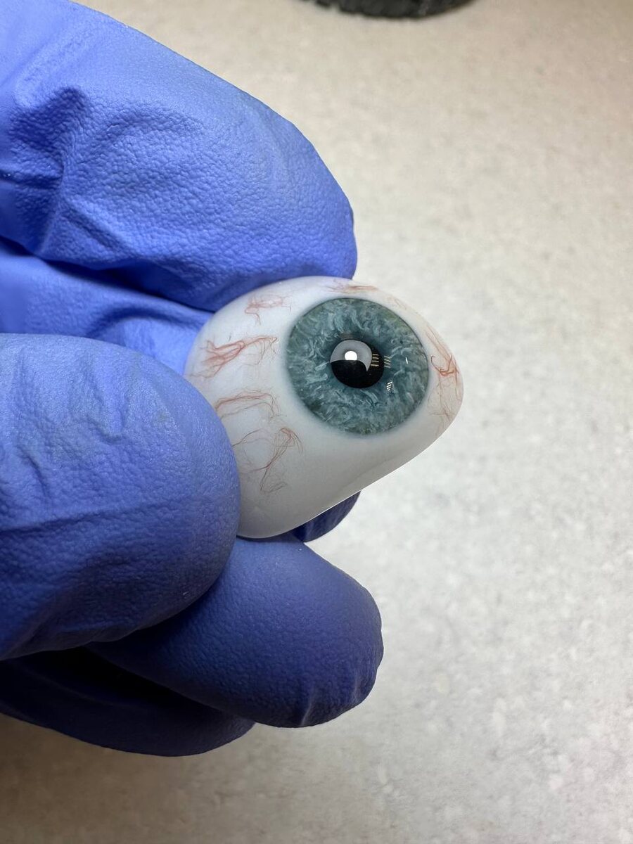 На фото глазной протез из высокопрочных пластмасс