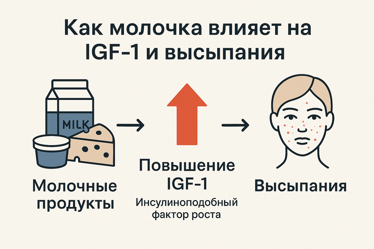 Как молочка влияет на IGF-1 и высыпания
