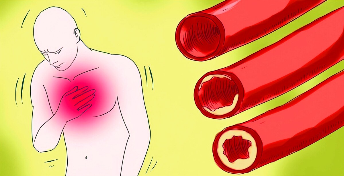 Что я почувствовала, когда у меня начали отказывать сосуды: Моя история осознания проблемы