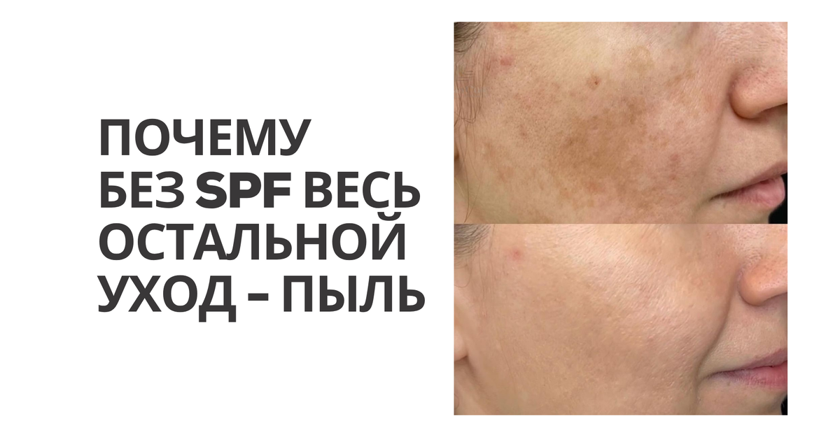 Почему без SPF весь остальной уход - пыль (и как не терять деньги, коллаген и время). 