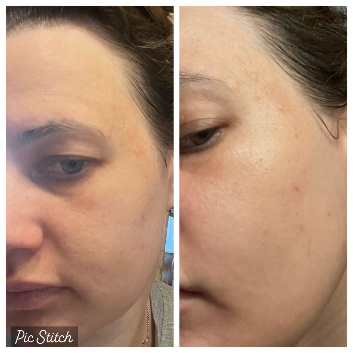 Слева фото до нанесения эссенции, справа после