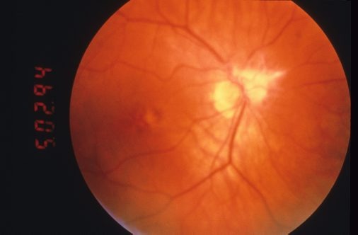    Фото: Custom Medical Stock Photo/Globallookpress