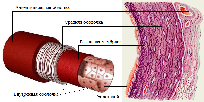 При расслоении имеется неполный разрыв/надрыв именно внутренней стенки (эндотелия), после чего кровь за счёт высокого давления распространяется между слоями аорты