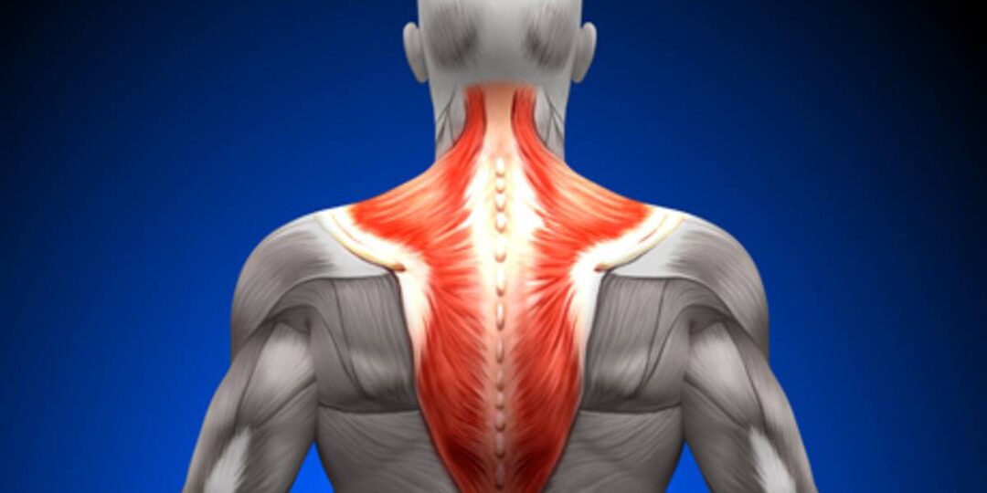 Головная боль от напряжения: как слабые мышцы шеи разрушают вашу жизнь
