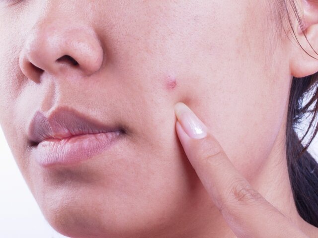    Фото: 123RF/nilket