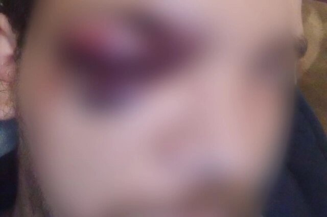    Сильнейший удар разрушил жизнь челябинца. Фото: Предоставлено героем публикации