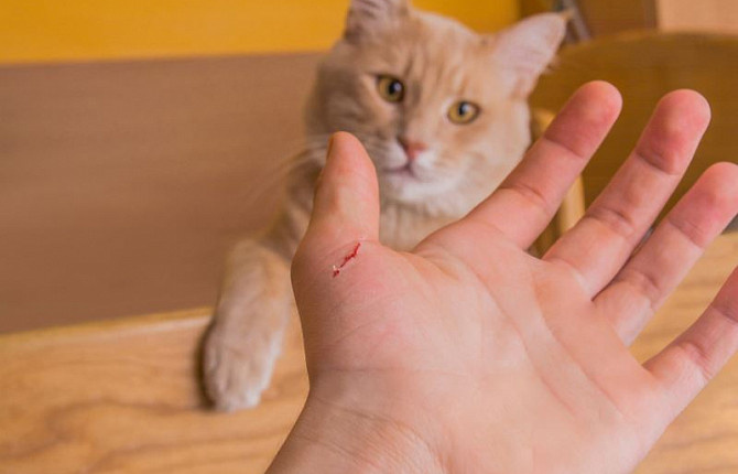 Врачи НИКИ детства рассказали о симптомах «болезни царапин»