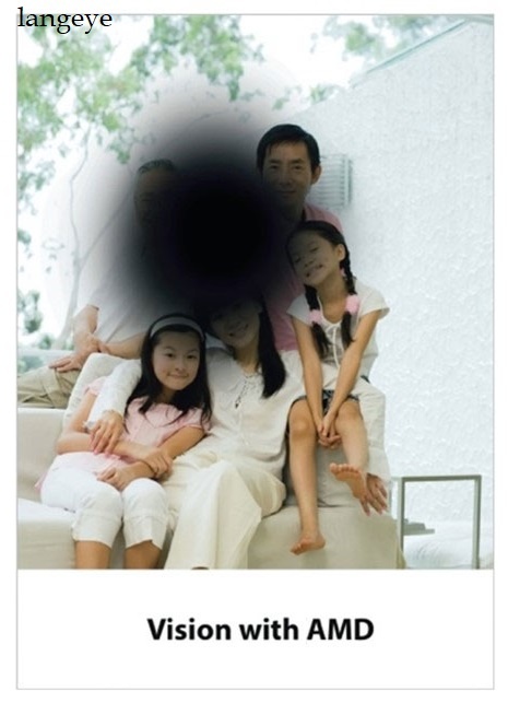 Как видят мир люди с возрастным разрушением макулы