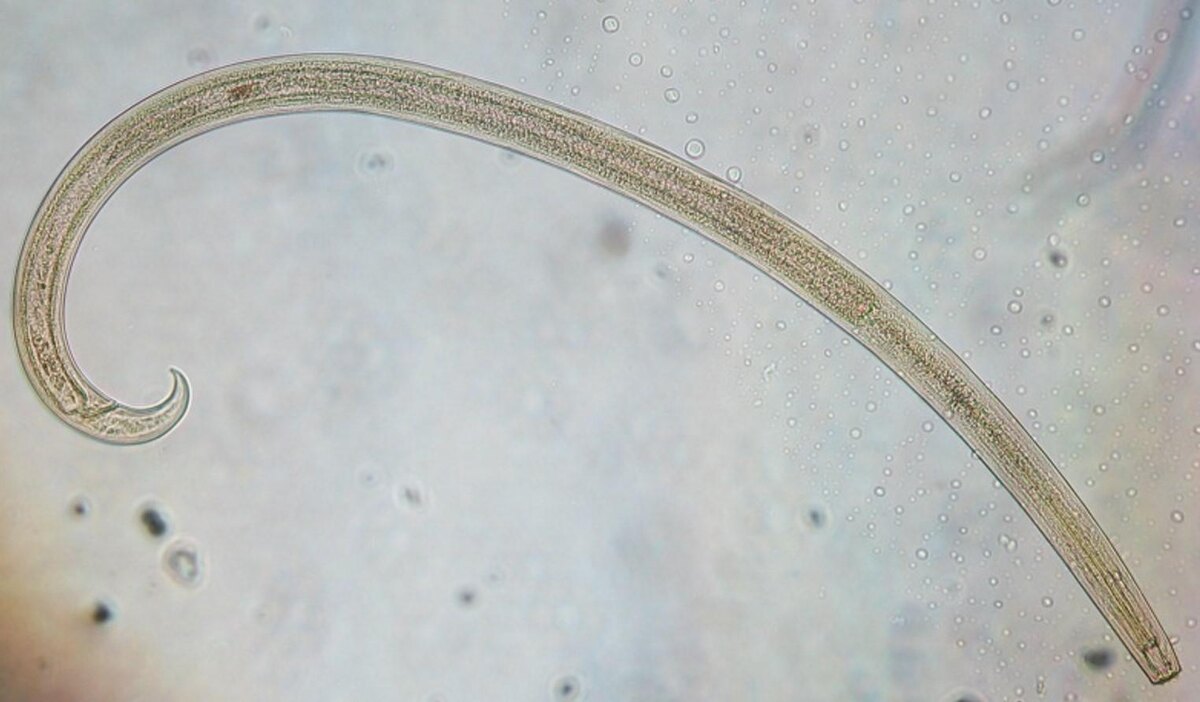 Cristina Menta / WIKIMEDIA COMMONS📷Взрослые особи и личинки нематод имеют схожее строение, но личинки обычно меньше и находятся в разных стадиях развития