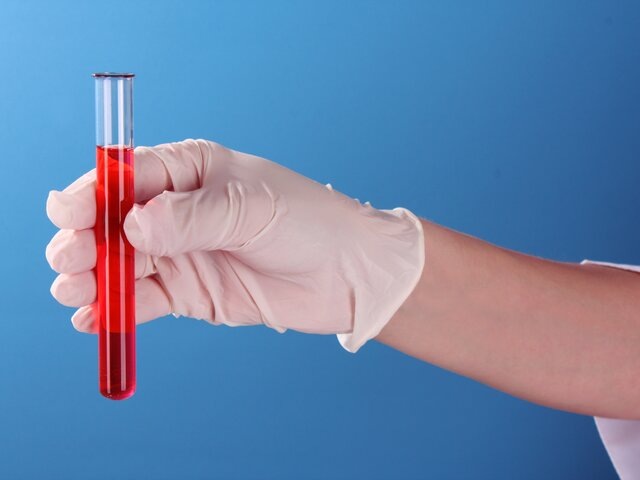    Фото: 123RF/serezniy