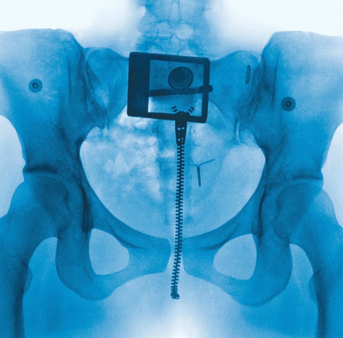 Обложка альбома