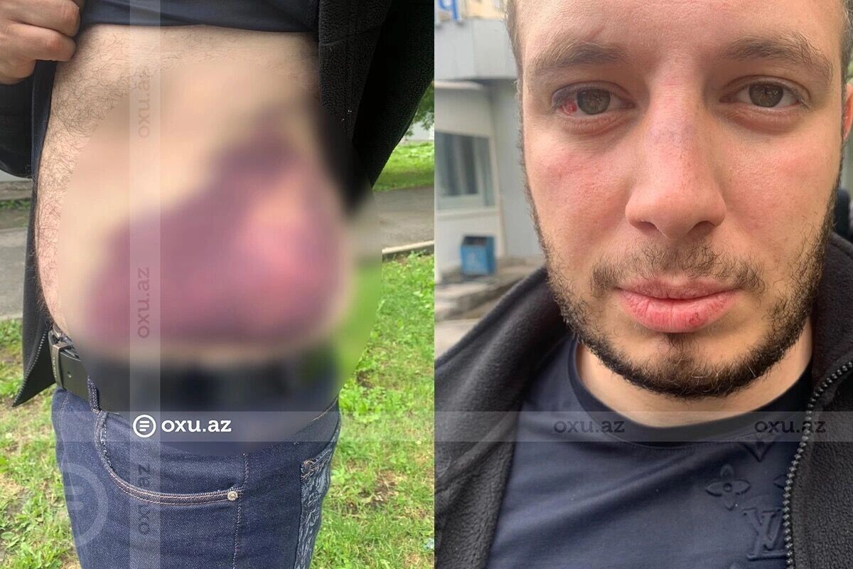 Бакинские СМ показывают фото пострадавших. Фото: Oxu.Az