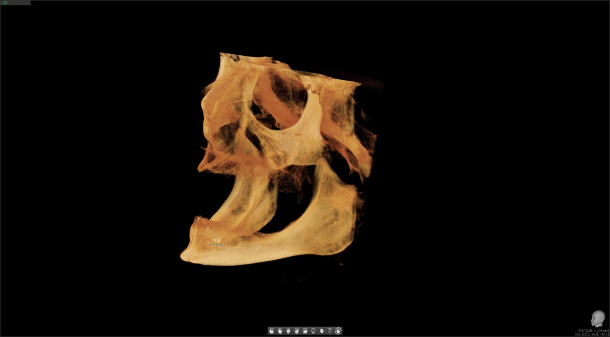 Визуализация КЛКТ