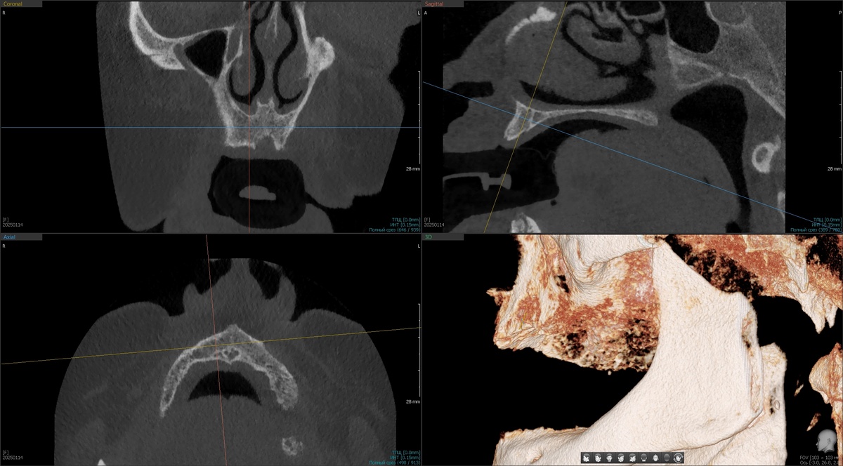 Фронтальный участок