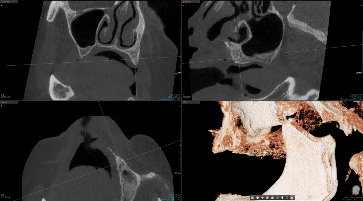 Боковая проекция