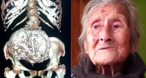 Фотоматериал из источника: http://www.bilenkadinlar.com