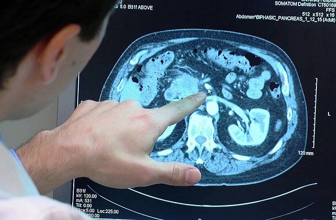 Руководство по раку поджелудочной железы. Часть 2: симптоматика и методы современной диагностики