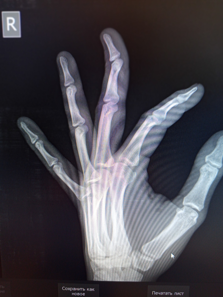 Третий палец.