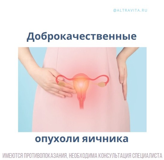 Доброкачественные опухоли яичника