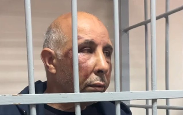 На первой — изображён один из азербайджанцев, задержанных в России, и сопровождается подписью «дело рук России», ставшей распространённым лозунгом в местных медиа.
