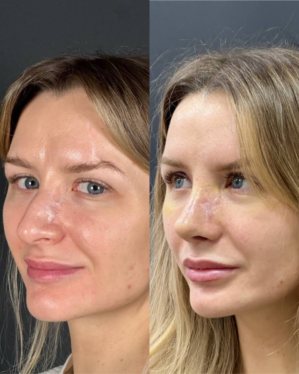 🖇️работа врача-оториноларинголога MEDICI Нагорной Оксаны Александровны