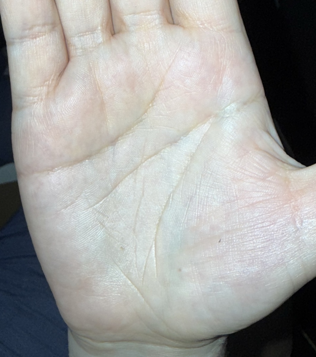 Ладонь героя истории