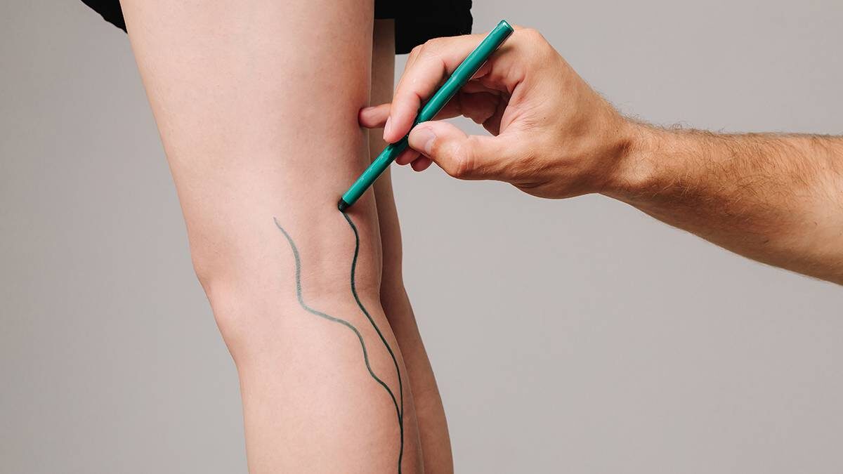    Фото: Shutterstock