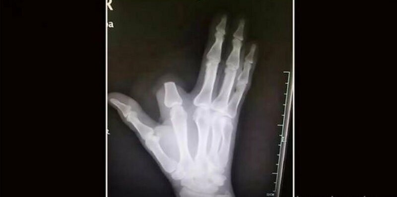    15 смешных доказательств того, что мужчины слишком рискованные