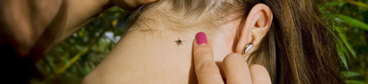 Обнаружили клеща? Действуйте быстро и правильно!