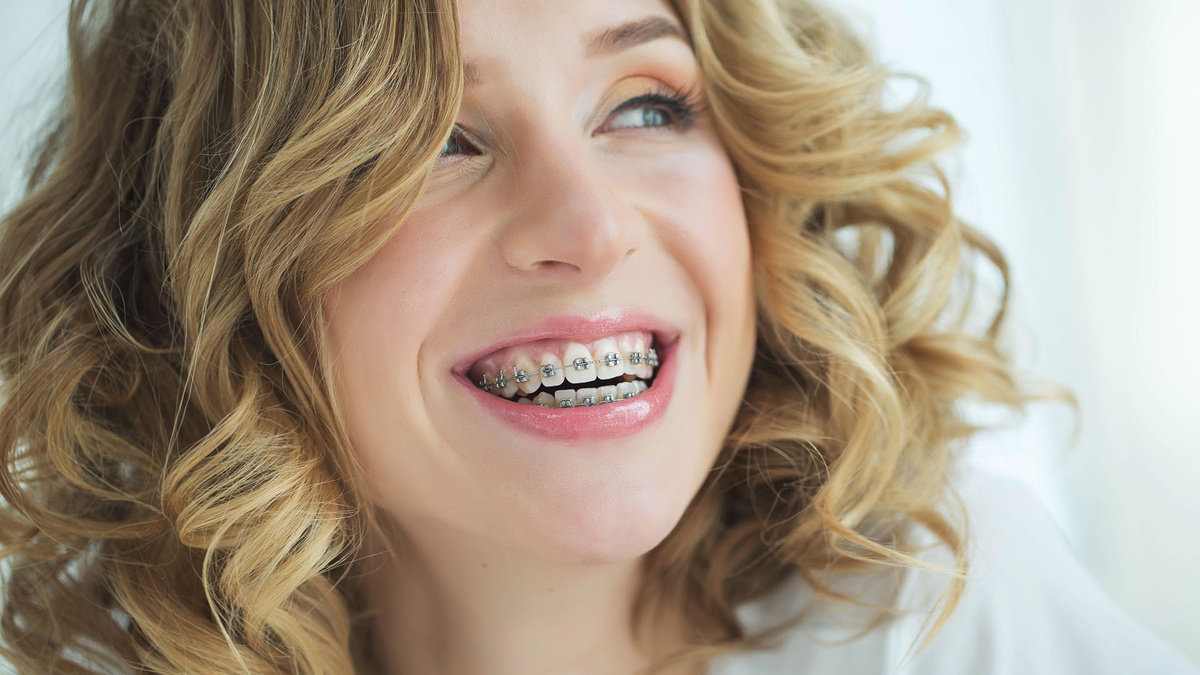 Больно ли ставить брекеты: отвечает  врач-ортодонт клиники «Рестом», Санкт-Петербург