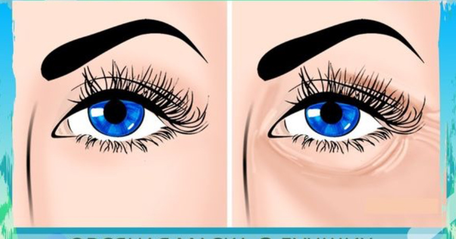 Долой утренние отёки вокруг глаз: 3 экспресс техники, которые мне помогают