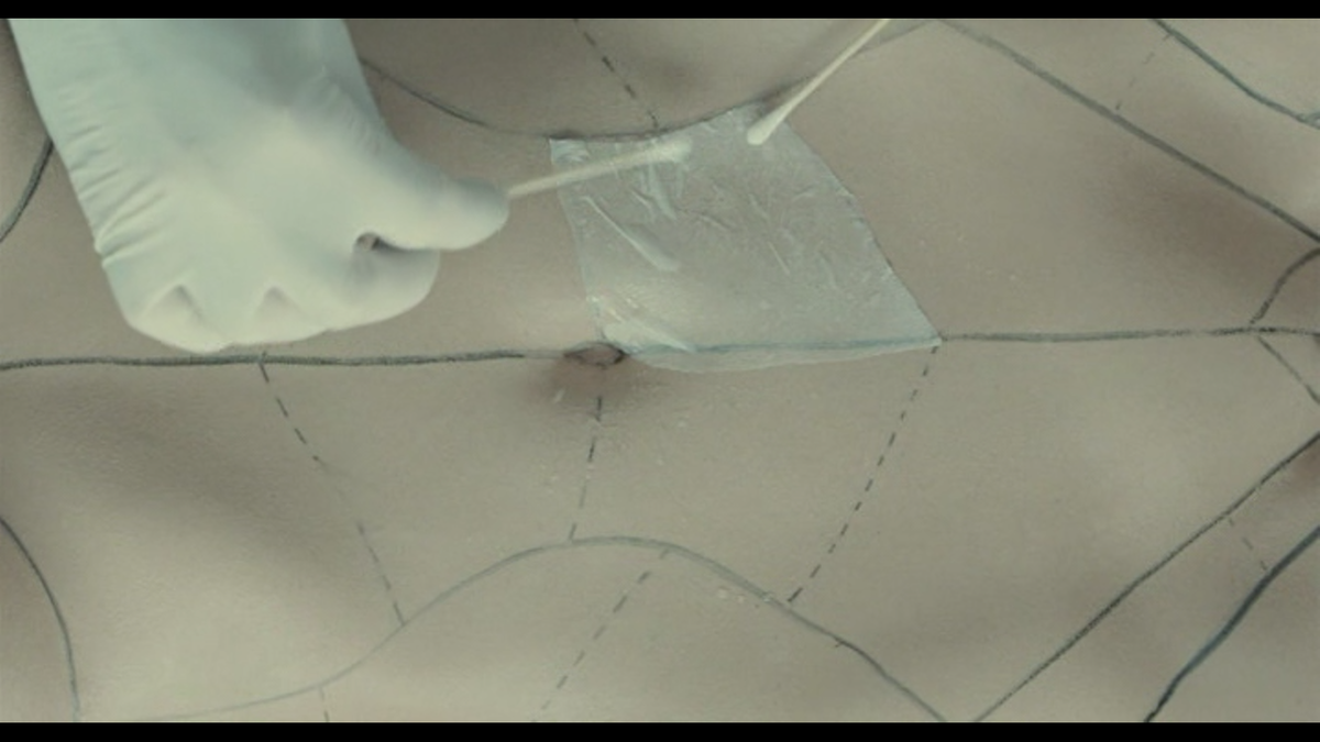 фрагмент выращенной искусственной кожи