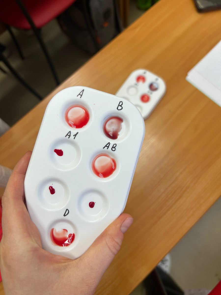 Первая отрицательная