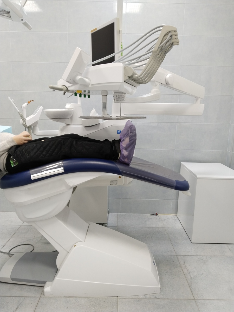 Пластика уздечки верхней губы